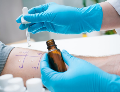 What Is Allergy and Immunology Treatment? (Easy Guide)