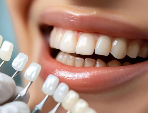 What Is Cosmetic Dentistry Treatment? A Complete Easy Guide