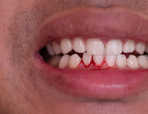 Why Do My Gums Bleed When Brushing? A Simple Guide to Causes, Care, and Prevention