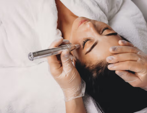 How to Remove Dark Spots Naturally: A Simple and Complete Guide