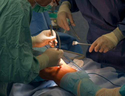 Is Knee Replacement Surgery Safe? A Simple and Complete Guide